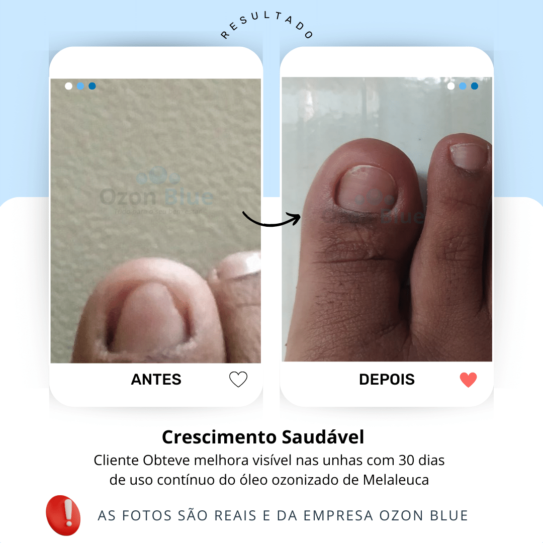Óleo de Melaleuca Ozonizado - Imagem 3