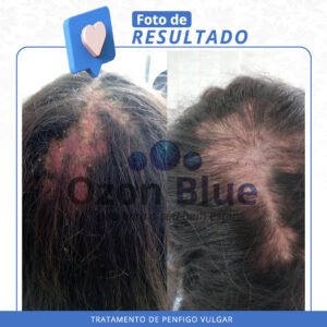 Alternative view of Shampoo